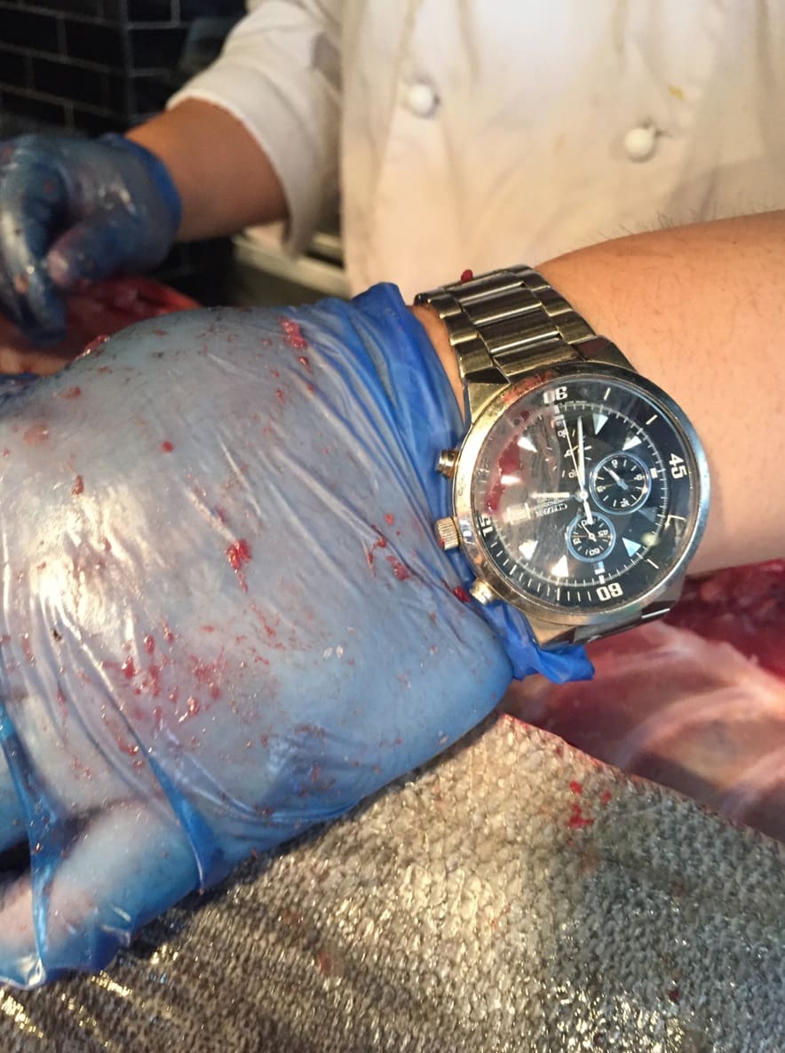 MY WATCH STORY: Justin’s (blood-smeared) Citizen Chronograph